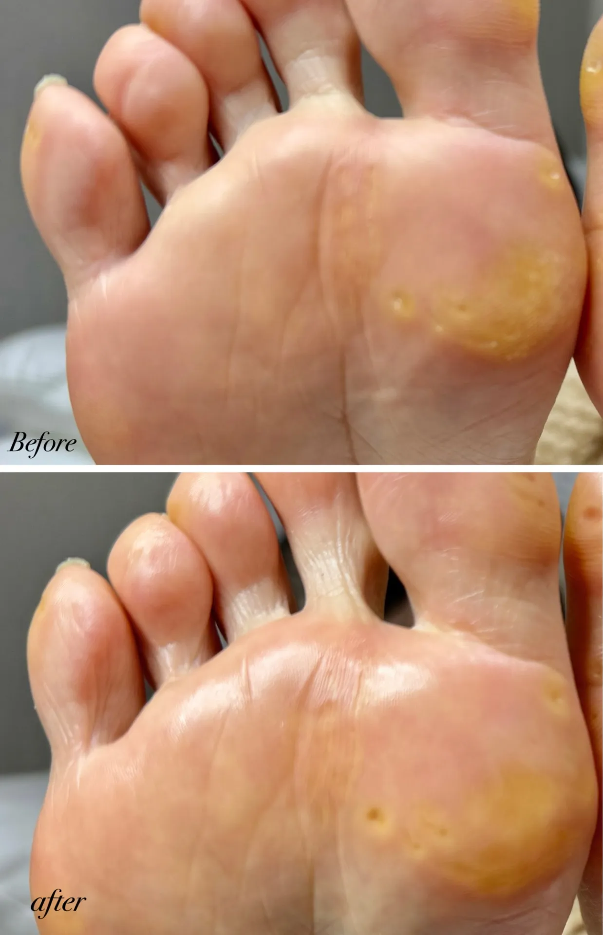 臭いの原因？足裏