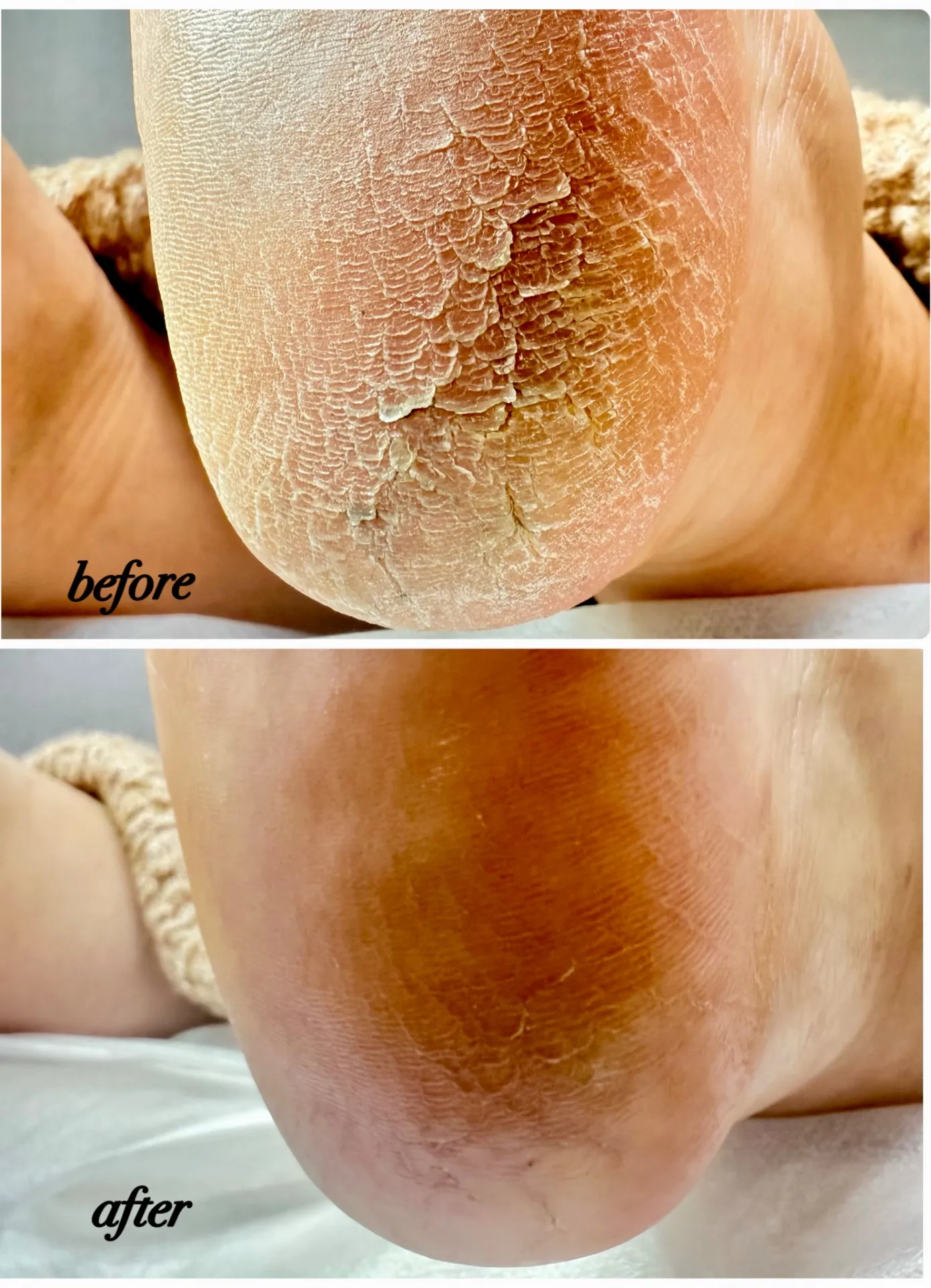 引っかかり自分ではどうにもならない