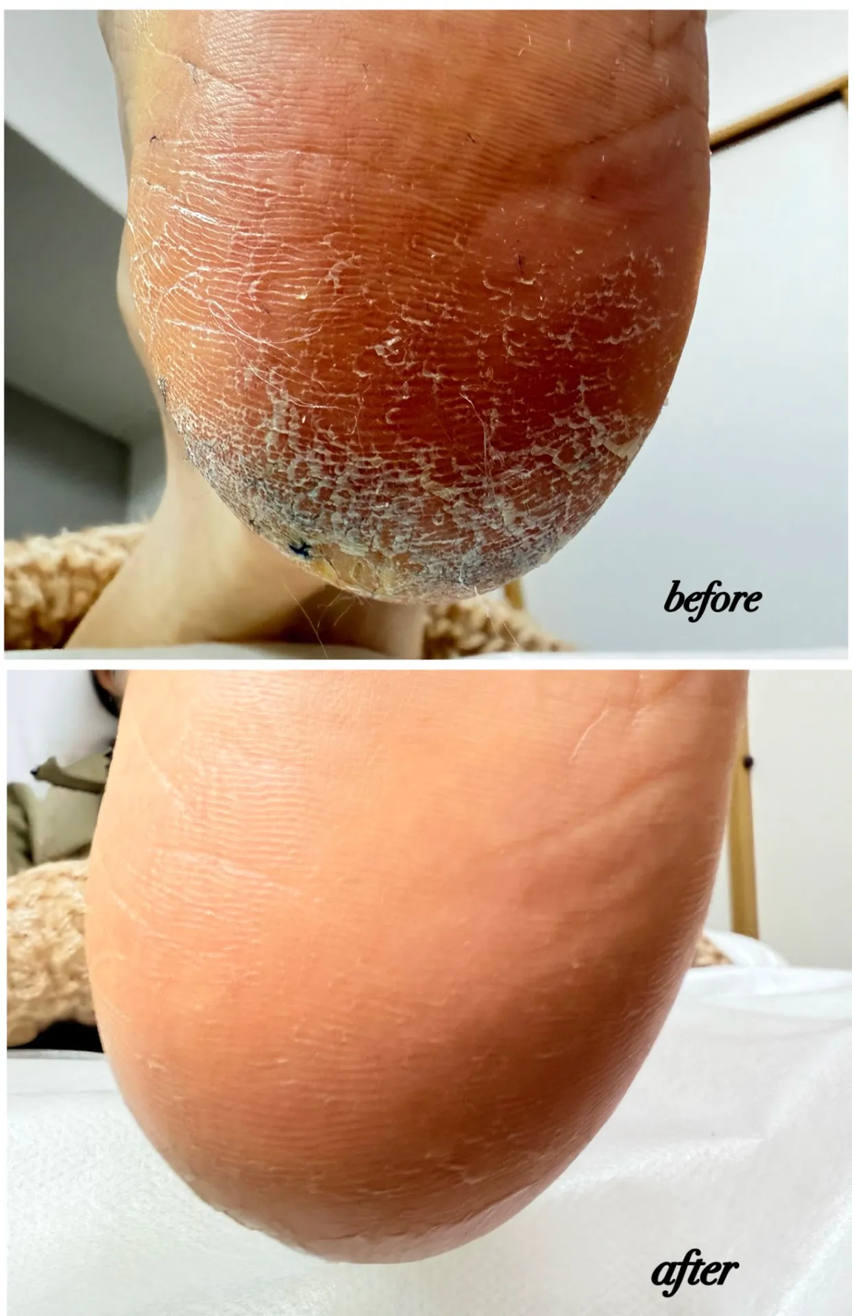 かかとのみケアは他にはない?