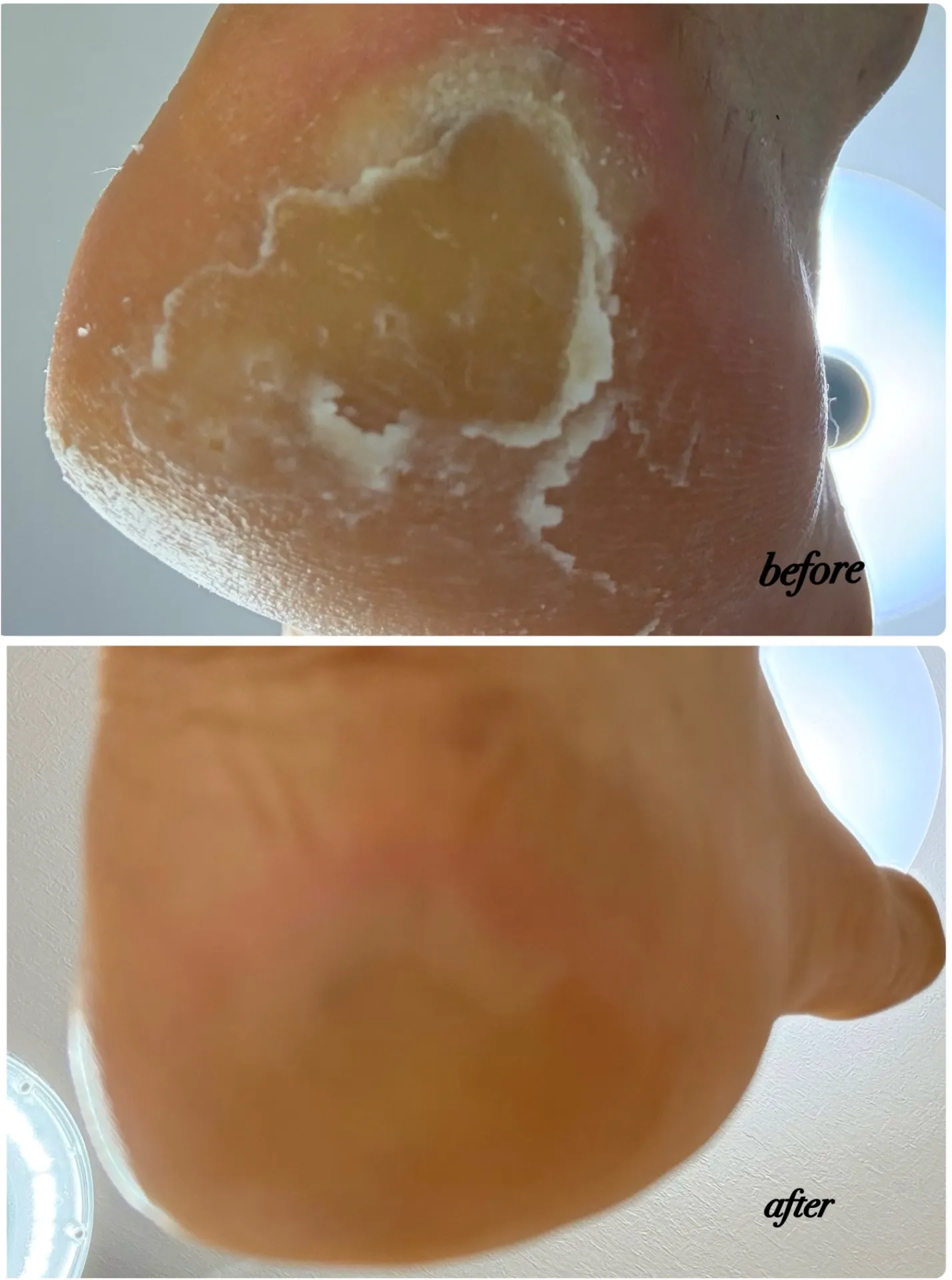 セルフケアでガチガチに